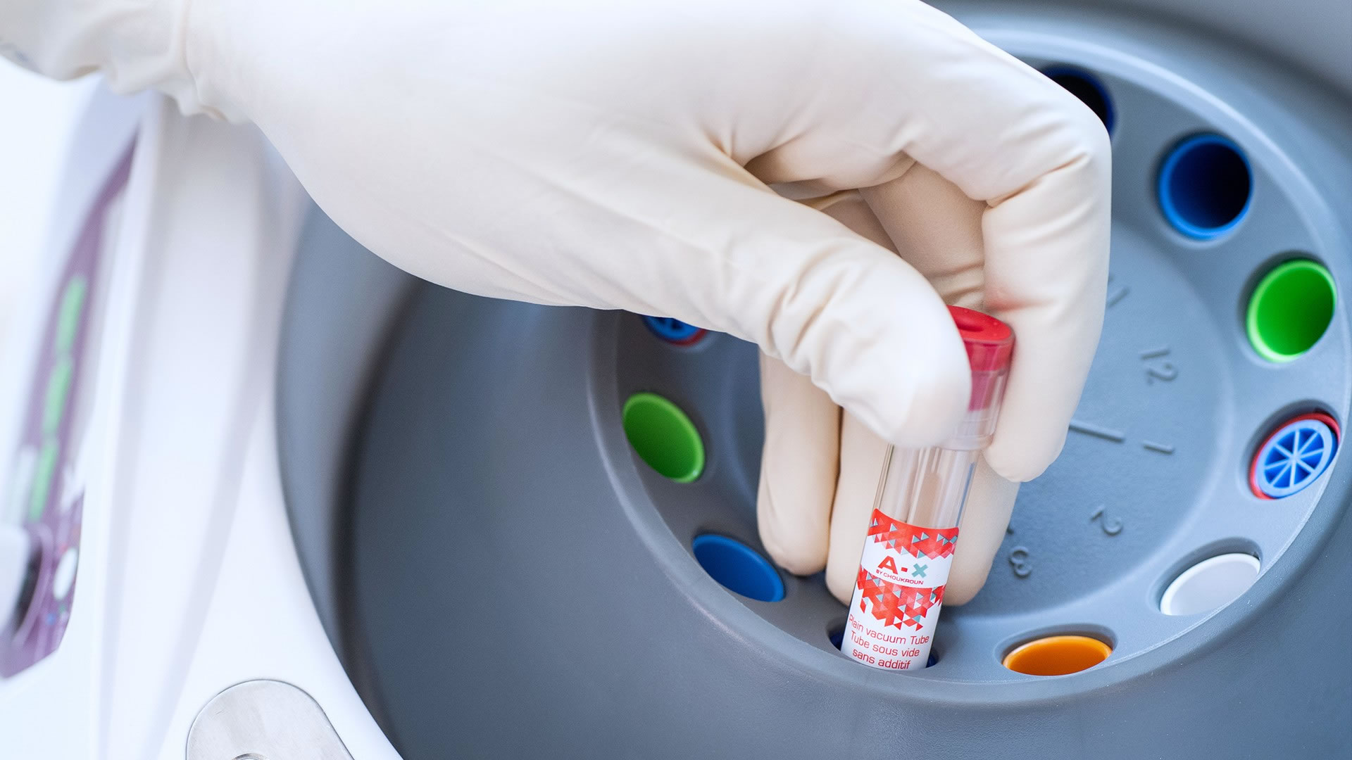 regenerative-chirurgie-prf